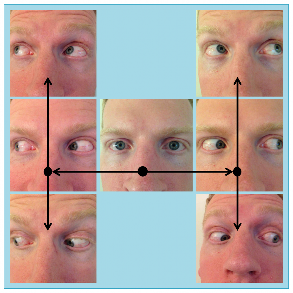 Moran CORE The Motility Exam