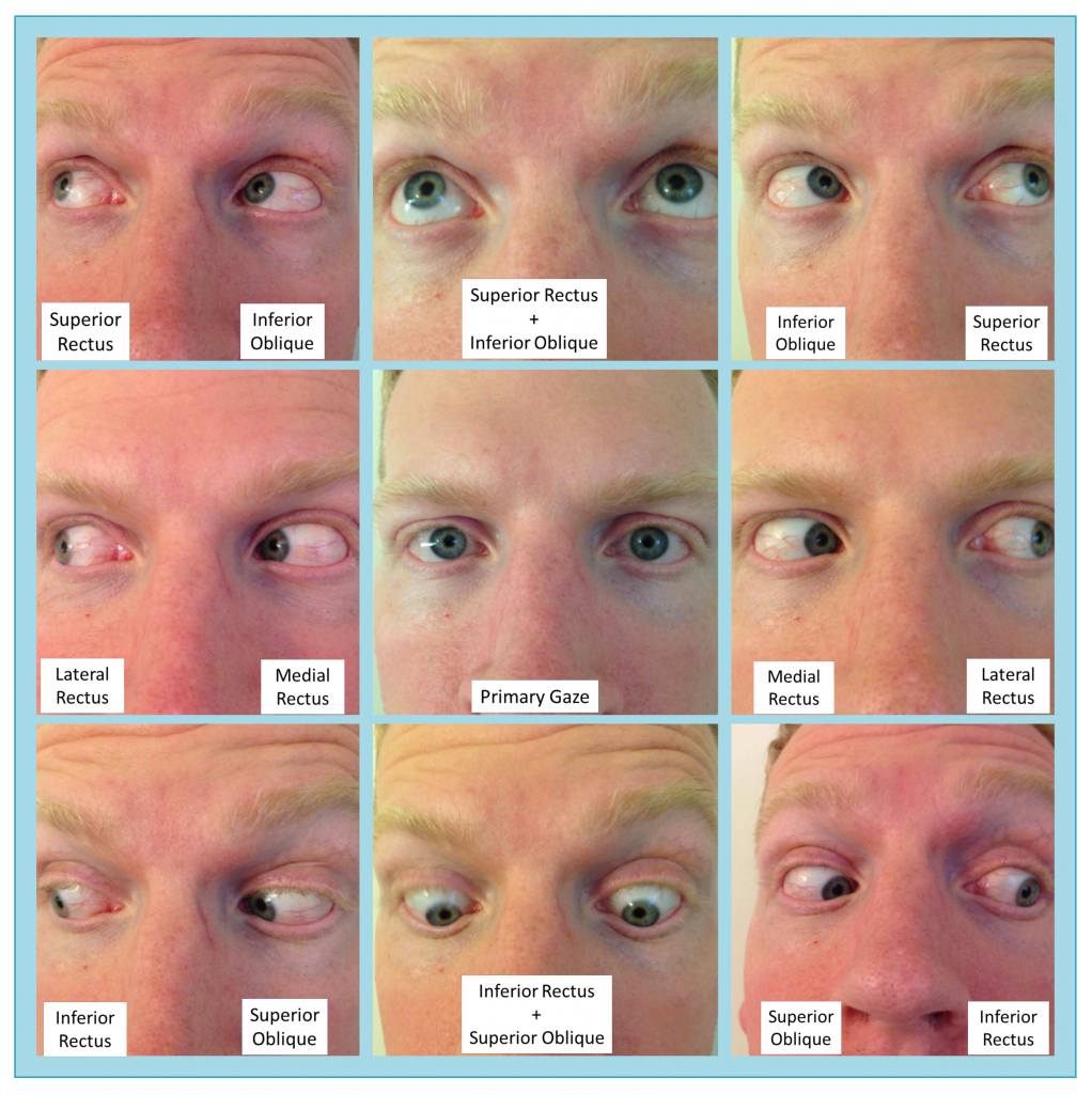 Moran CORE The Motility Exam