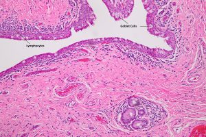 Mamalis_Conjunctiva_02_labeled