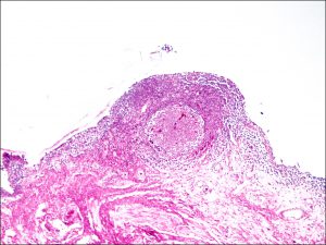 Mamalis_Conjunctiva_13_unlabeled