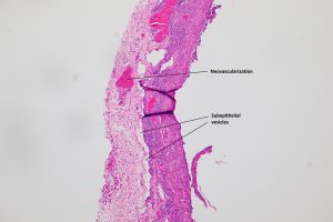 Mamalis_Conjunctiva_19_labeled