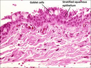 Mamalis_Conjunctiva_29_labeled