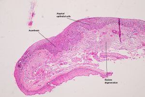 Mamalis_Conjunctiva_31_labeled