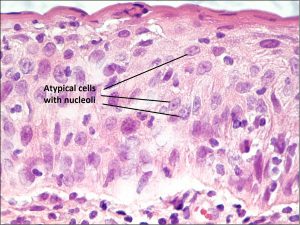 Mamalis_Conjunctiva_36_labeled