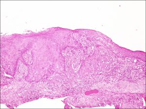 Mamalis_Conjunctiva_38_unlabeled