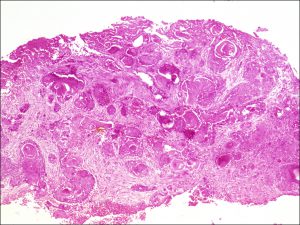 Mamalis_Conjunctiva_39_unlabeled