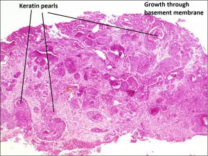 Mamalis_Conjunctiva_39_labeled