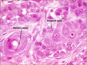 Mamalis_Conjunctiva_40_labeled