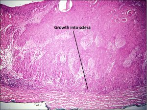 Mamalis_Conjunctiva_41_labeled