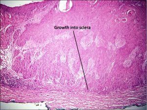 Mamalis_Conjunctiva_41_labeled