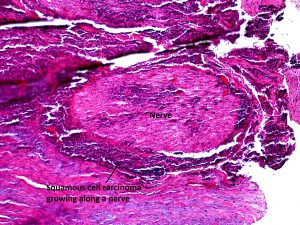 Mamalis_Conjunctiva_42_labeled