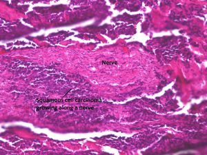 Mamalis_Conjunctiva_43_labeled