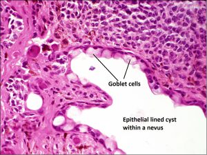 Mamalis_Conjunctiva_46_labeled