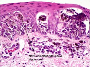 Mamalis_Conjunctiva_47_labeled