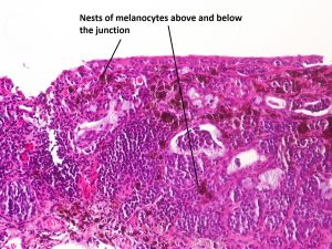 Mamalis_Conjunctiva_48_labeled