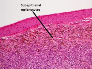 Mamalis_Conjunctiva_49_labeled