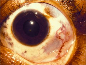 Mamalis_Conjunctiva_50_unlabeled