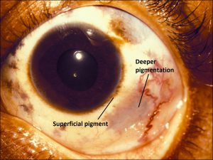 Mamalis_Conjunctiva_50_labeled