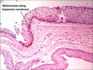 Mamalis_Conjunctiva_52_unlabeled