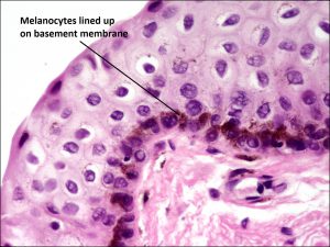 Mamalis_Conjunctiva_53_labeled