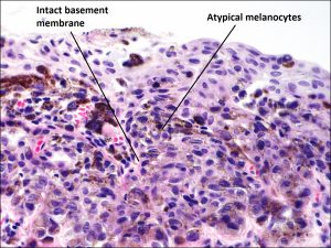 Mamalis_Conjunctiva_55_labeled