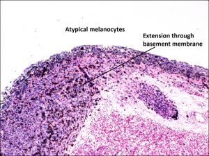 Mamalis_Conjuctiva_57_labeled