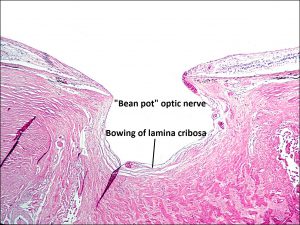 Mamalis_Ant_Chamber_13_labeled