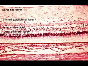 Mamalis_Ant_Chamber_15_labeled