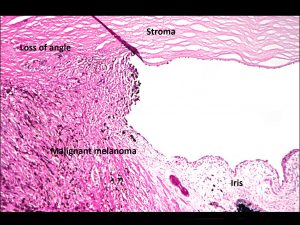 Mamalis_Ant_Chamber_35_labeled