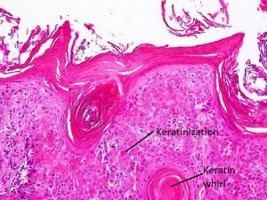 Mamalis Eyelid 06 labeled