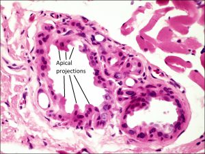 Mamalis Eyelid 10 labeled