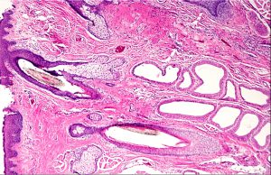 Mamalis Eyelid 11 unlabeled