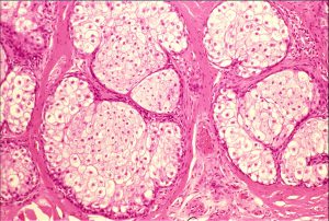 Mamalis Eyelid 12 unlabeled