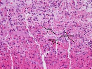 Mamalis Eyelid 17 labeled