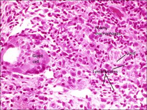 Mamalis Eyelid 23 labeled