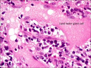 Mamalis Eyelid 24 labeled