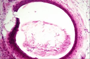 Mamalis Eyelid 28 unlabeled