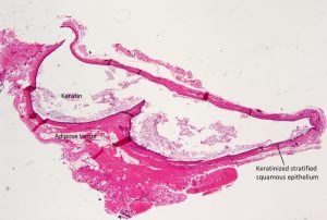 Mamalis Eyelid 30 labeled