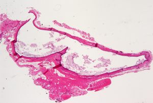 Mamalis Eyelid 30 unlabeled