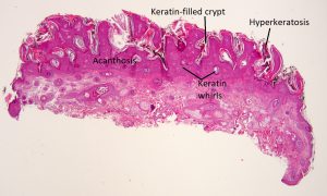 Mamalis Eyelid 36 labeled