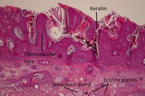 Mamalis Eyelid 37 labeled