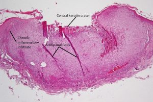 Mamalis Eyelid 42 labeled