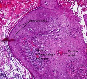 Mamalis Eyelid 45 labeled