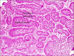 Mamalis Eyelid 48 labeled