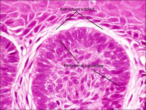 Mamalis Eyelid 49 labeled