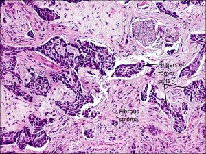 Mamalis Eyelid 51 labeled