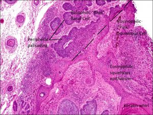 Mamalis Eyelid 52 labeled