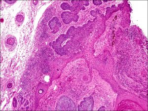 Mamalis Eyelid 52 unlabeled