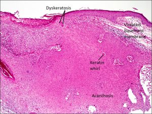 Mamalis Eyelid 56 labeled