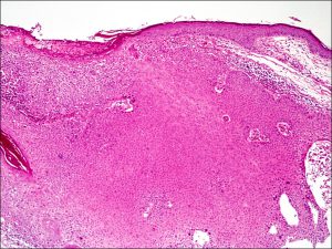 Mamalis Eyelid 56 unlabeled